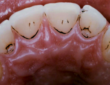 bacteriascromogenicas
